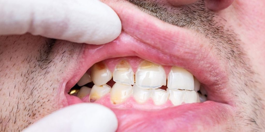 dentist in Fairfax, VA